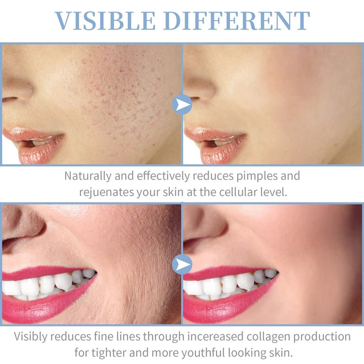 High-Frequency Facial Wand 4-in-1 – Acne, Ageing, Scalp