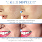 High-Frequency Facial Wand 4-in-1 – Acne, Ageing, Scalp