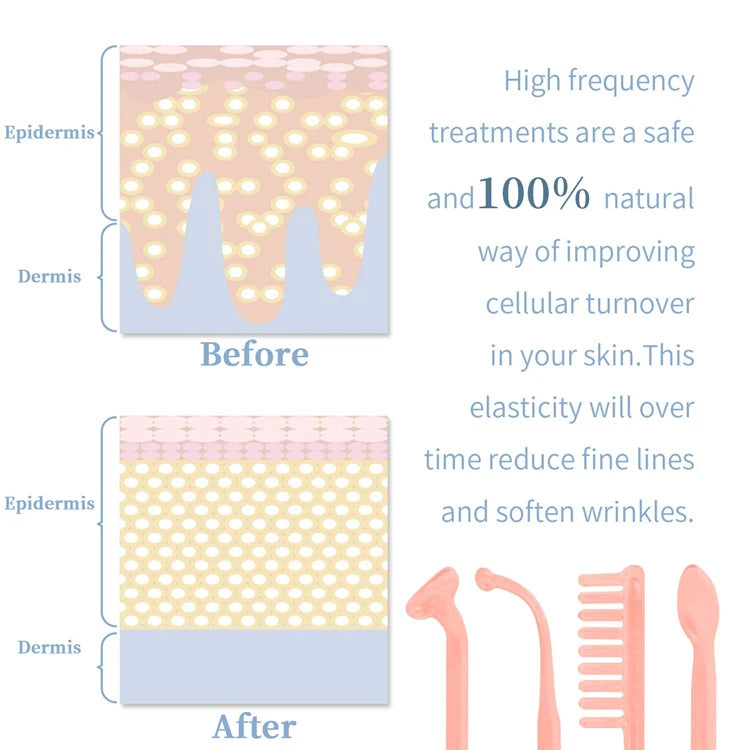 High-Frequency Facial Wand 4-in-1 – Acne, Ageing, Scalp