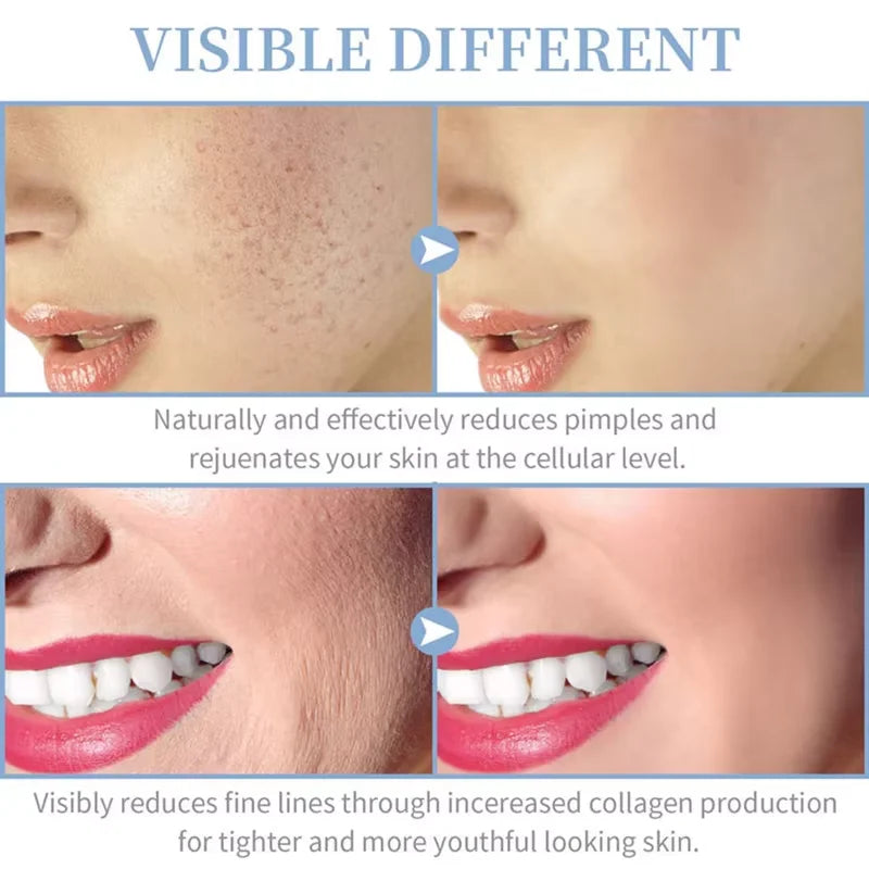 High-Frequency Facial Wand 4-in-1 – Acne, Ageing, Scalp