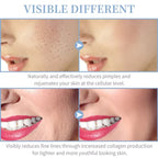 High-Frequency Facial Wand 4-in-1 – Acne, Ageing, Scalp