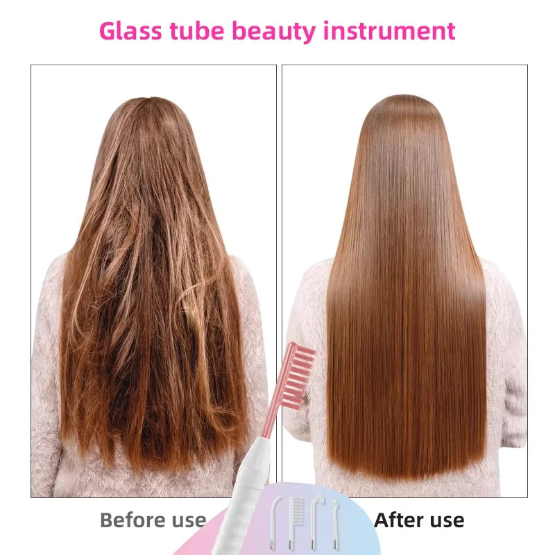 High-Frequency Facial Wand 4-in-1 – Acne, Ageing, Scalp