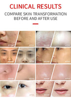 7 Colors LED Face Mask Skin Care